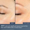 image:imageSummer Fridays Bright Eyes Duo  Light Aura Vitamin C  Peptide Eye Cream 05 Fl Oz Jet Lag Overnight Eye Serum 05 Fl Oz Hydrate Smooth amp Depuff