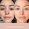 image:imageSummer Fridays Cloud Dew Gel Cream Face Moisturizer with Hyaluronic Acid amp Ceramides 17 Fl Oz  CC Me Vitamin C Serum with Niacinamide amp Natural Antioxidants for Dark Spot Correcting 1 Fl Oz