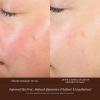 image:imageSummer Fridays Evening Duo  Travel Size Jet Lag Face Mask  Midnight Ritual Retinol Serum  Overnight Skin Care Set With Hyaluronic Acid  Niacinamide for Hydrated  Smooth Skin 2 Count