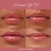 image:imageSummer Fridays Dream Lip Oil Set  High Shine NonSticky Skin Care Infused Tinted Lip Gloss Oil with Hydrating Vitamin E  Includes Rosewoods Nights Pink Cloud Soft Mauve  Blush Dreams 4 ctBlush Dreams